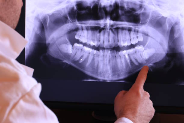 Best Dentist for Tooth Abscess  in Lake Stevens, WA
