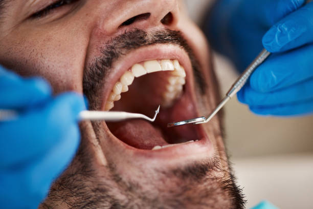 Best Cracked Tooth Emergency Dentist  in Lake Stevens, WA
